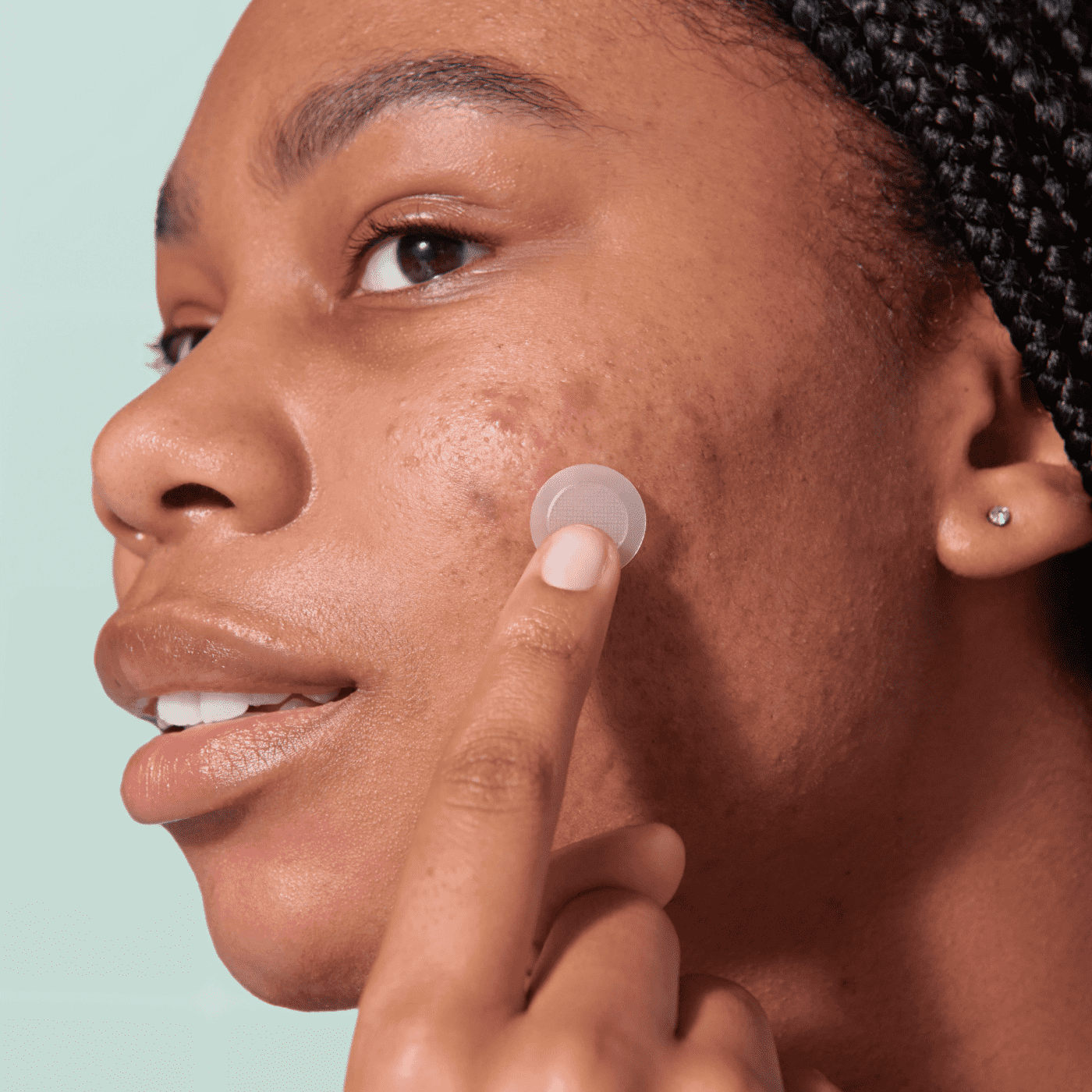 Mighty Patch™ for Early-Stage Blemishes - Modern Choice