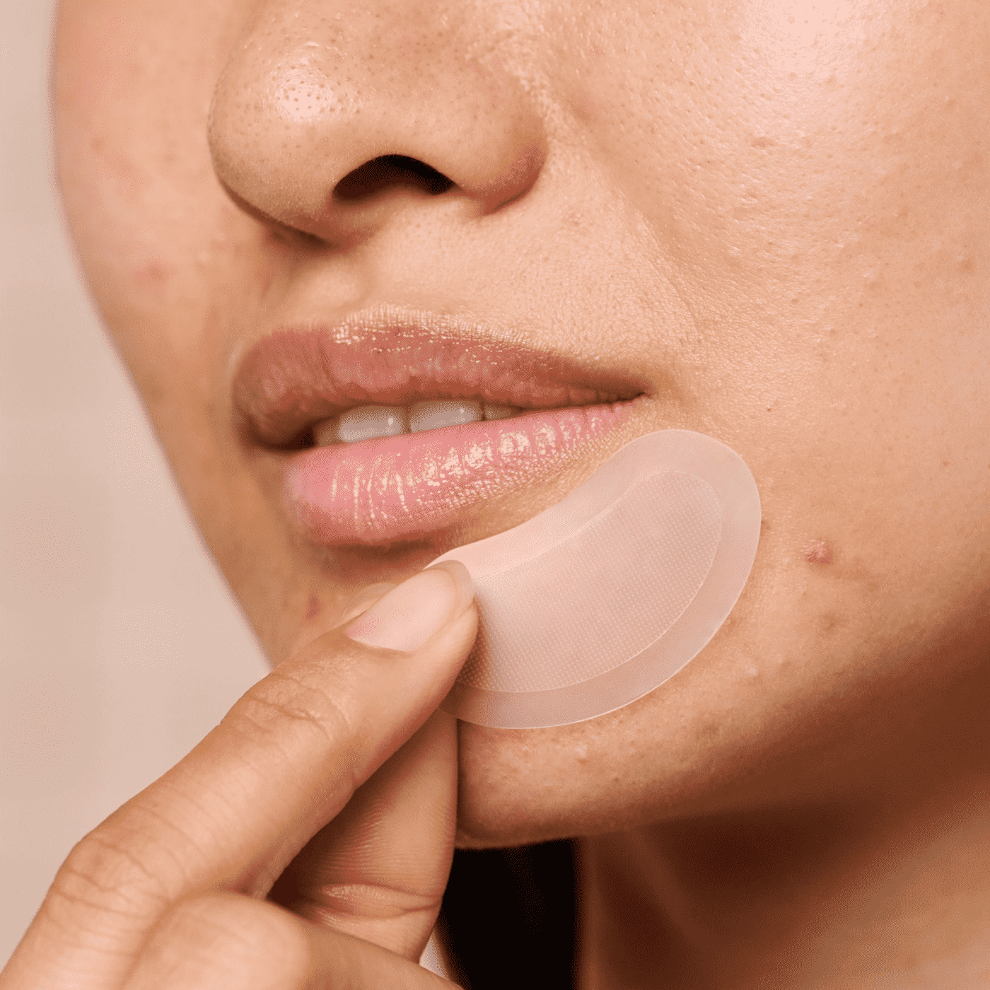 Mighty Patch™ for XL Early-Stage Blemishes - Travel Style