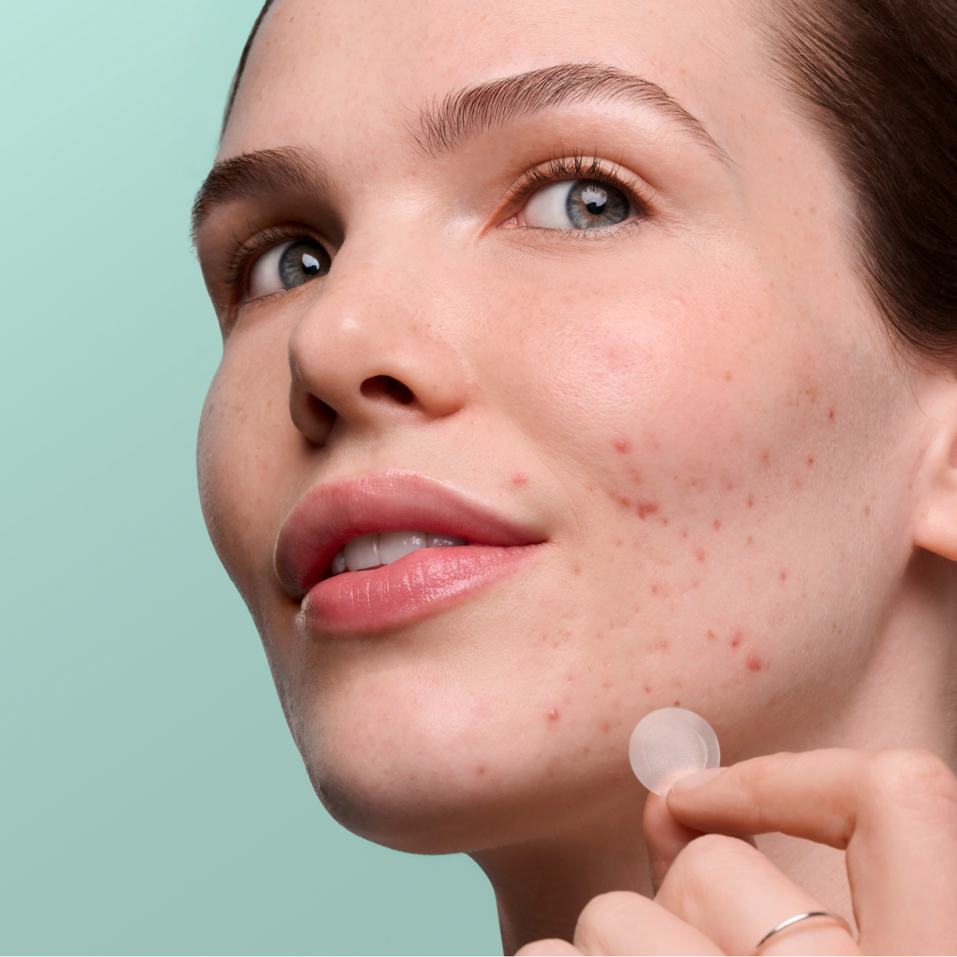 Pimple Patrol Duo - Premium Pick